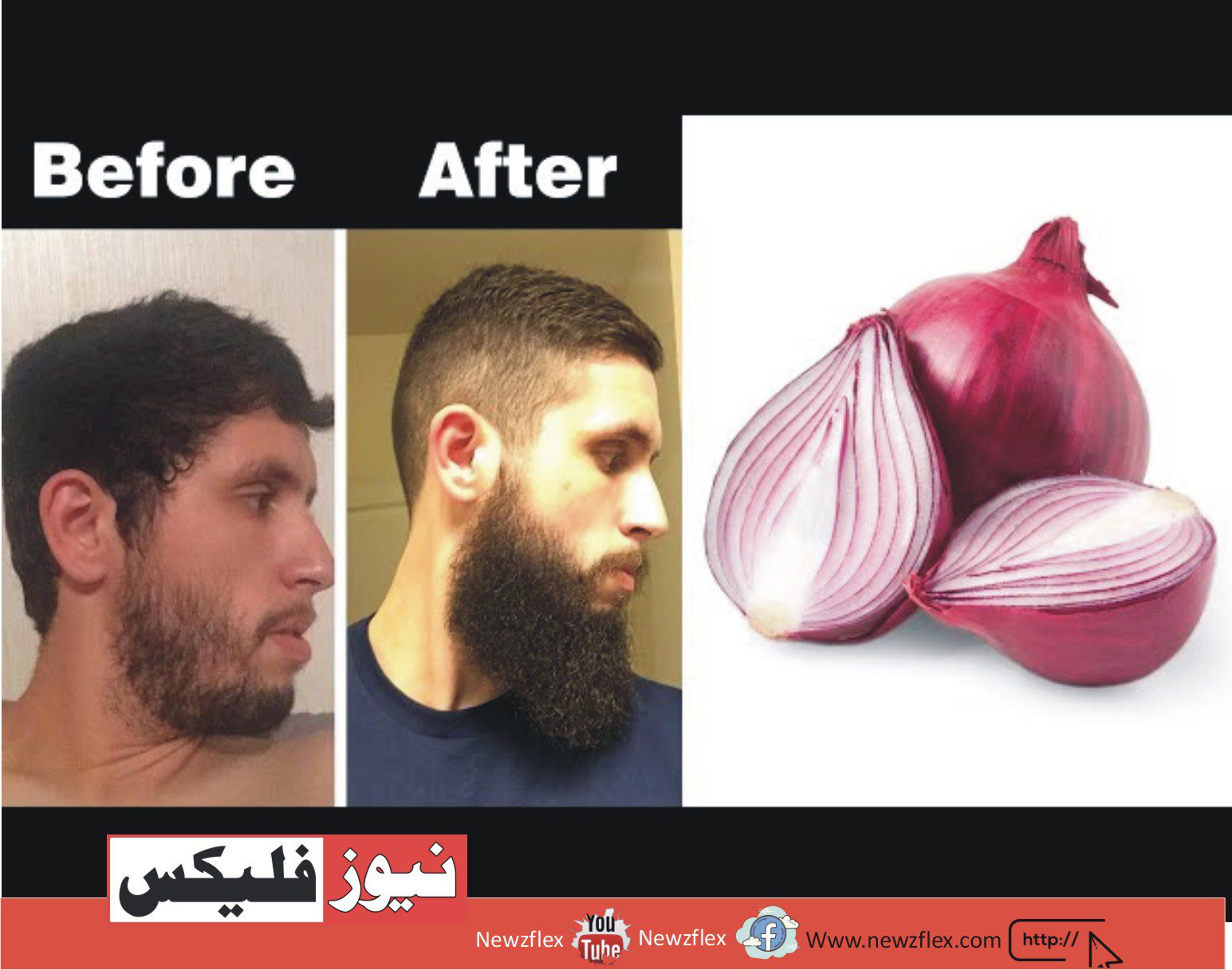 How To Increase Your Beard Growth Naturally at Home